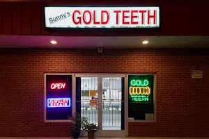 Sunny's Gold Teeth image