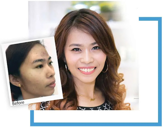 Skin Renew [Damansara Utama] - Skin Renew [Damansara Utama]