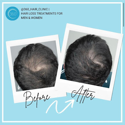 360 Hair Clinic - 360 Hair Clinic
