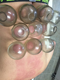 Acupuncture Bishop - Photo 4 - Car repair in Loxahatchee, FL, West Palm Beach