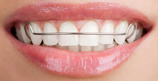 Full Smile Orthodontics