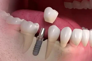 Swiss Dental Care image