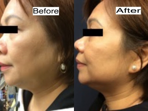 Explore infinity tattoo ideas for couples, creative tattoo ideas in Lake Oswego, available at Lake Oswego Vein and Aesthetic LOVA