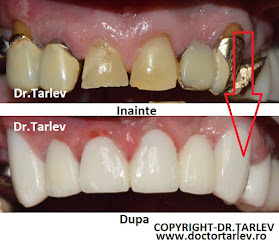 Doctor Tarlev - Cabinet Stomatologic