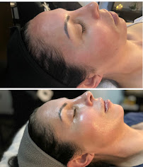 Face to Face Skincare - Photo 8 - Car repair in Westminster, CO, Arvada