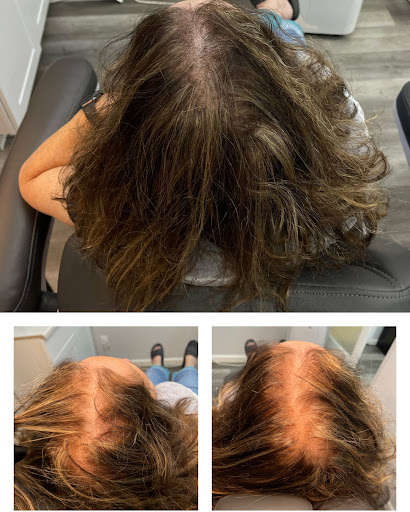 Explore italy tattoo ideas, creative tattoo ideas in Roseville, available at NuHair Ink. Scalp MicroPigmentation & Aesthetic Clinic of Sacramento