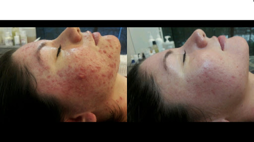 Skintherapy Skincare & Acne Clinic
