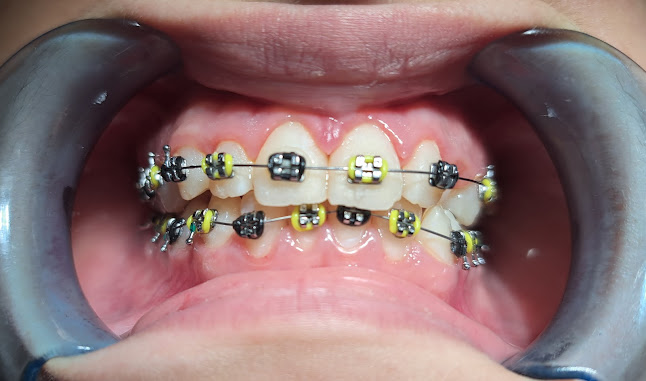 Zahnarzt Turbenthal Öffnungszeiten