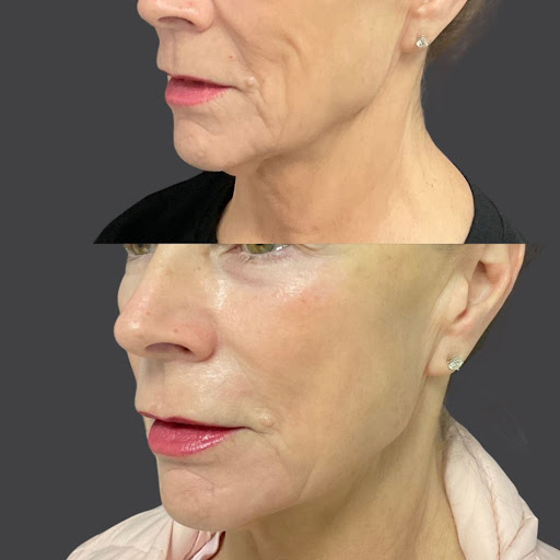 Explore texas rangers tattoo ideas, creative tattoo ideas in Whittier, available at Skin Perfect Medical Aesthetics