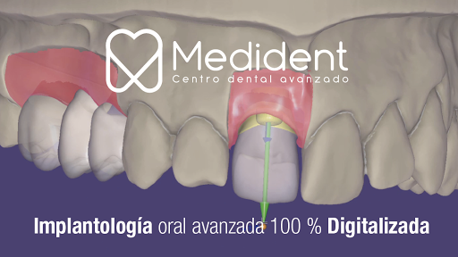 Clinica Dental Medident Torremolinos - Pl. Federico Garcia Lorca, 14, 29620 Torremolinos, Málaga