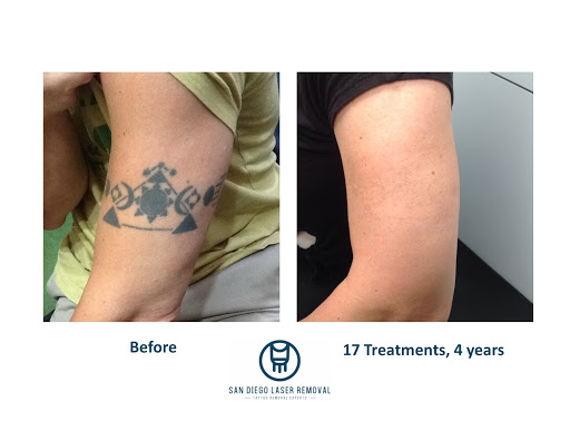 Explore santa muerte tattoo ideas, creative tattoo ideas in San Diego, available at Removery Tattoo Removal & Fading