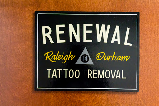 Explore original tattoo ideas, creative tattoo ideas in Raleigh, available at Renewal Tattoo Removal