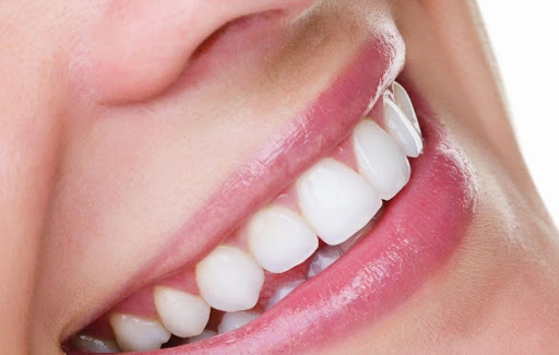 Teeth Whitening Adelaide - 20%OFF