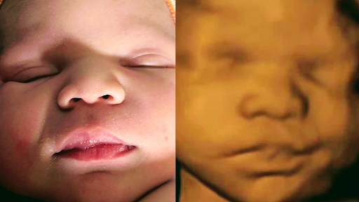 Next Generation Prenatal Imaging - Arden