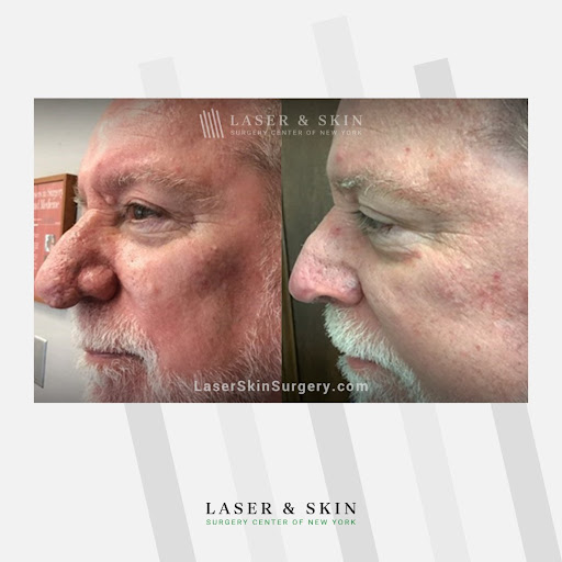 Explore small tattoo ideas for men arm, creative tattoo ideas in Southampton, available at Laser & Skin Surgery Center of New York - Southampton