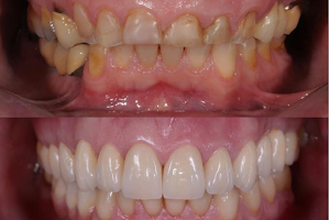 Dr. Bassem Abukanon, Cosmetic Dentistry Expert image