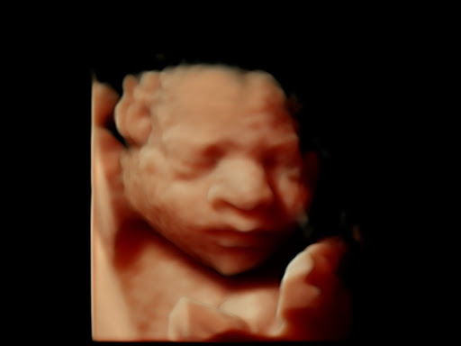 Mothers Precious Moments - 4D HDLive Ultrasound Cherished Memories