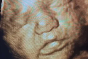Williamson Ultrasound image