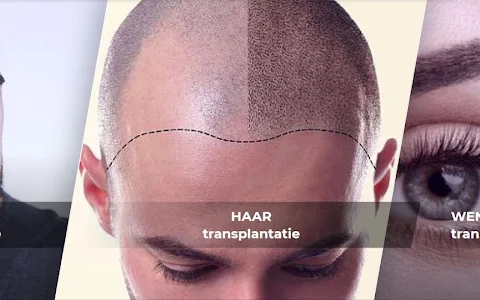 123 Haartransplantatie Turkije image