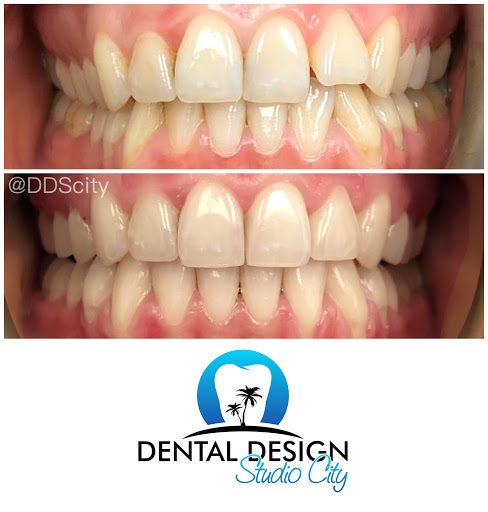 Dental Design Studio City image
