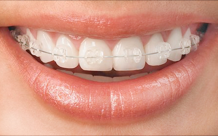 Opinii despre Smile Implant în <nil> - Dentist