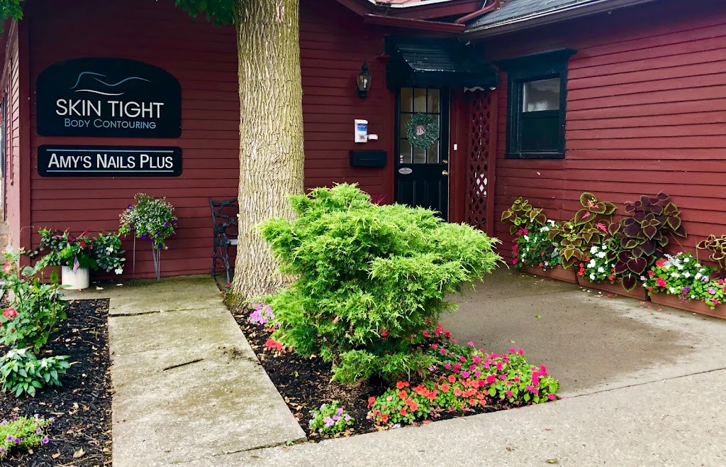 Skin Tight Body Contouring Lipo Laser & Spa Pittsford, NY 14534