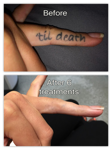 Explore portrait tattoos ideas, creative tattoo ideas in Honolulu, available at Removery Tattoo Removal & Fading