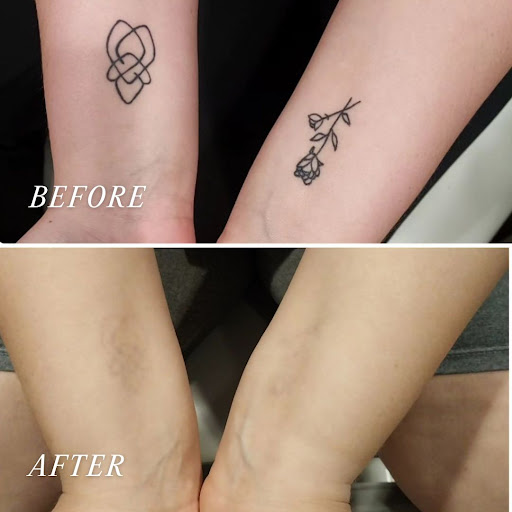 Explore honey tattoo ideas, creative tattoo ideas in Hendersonville, available at Skinworks Wellness & Aesthetics