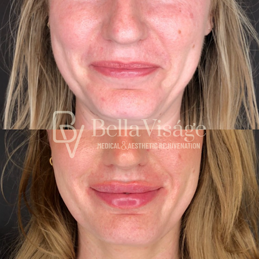 Explore kintsugi tattoo ideas, creative tattoo ideas in Lakeland, available at Bella Visge Medical & Aesthetic Rejuvenation