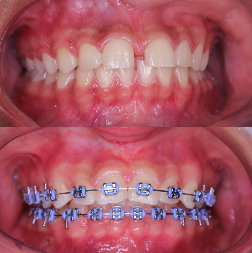 Consultorio Odontológico Odontosalud Lorica