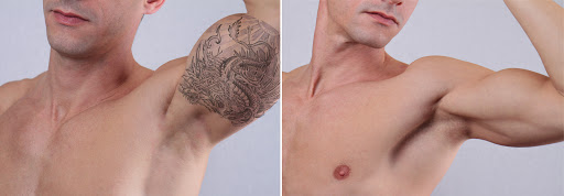 Explore halo game tattoo ideas, creative tattoo ideas in Broomfield, available at LaserAll