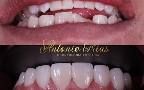 Dr. Antonio Frias - Odontología Estética image