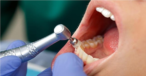 J&B Dental Implantology And Aesthetics