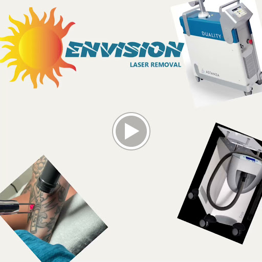 Explore barcode tattoo ideas, creative tattoo ideas in Port Charlotte, available at Envision Laser Removal