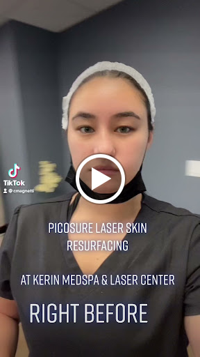 Kerin MedSpa & Laser Center- Michael Kerin MD image 7