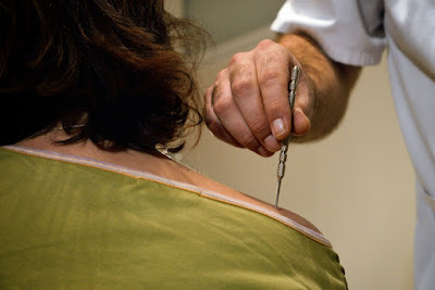 Centre de formation en acupuncture méthode Acu-AnMo à Auch