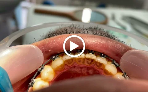 Butik Dental Ortodonti Uzmanı Dr. Yusuf Ozan Topçu Diş Hekimi Dt. Özge Topçu Ortodonti İzmir image