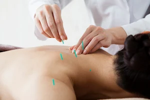 Well Health Acupuncture image