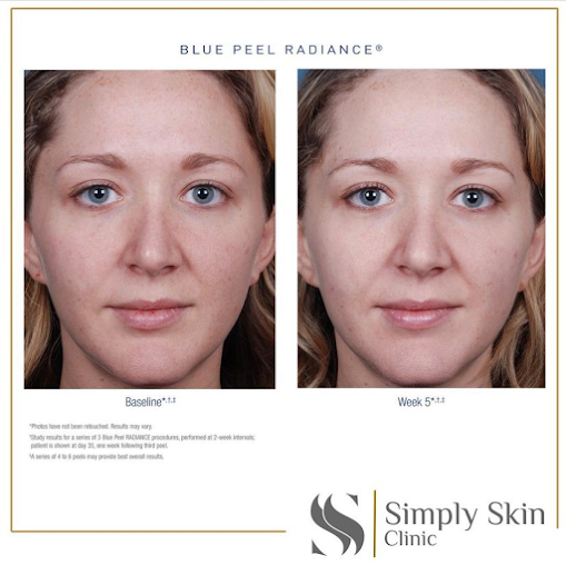 عيادة Skinplicity - Skinplicity Clinic