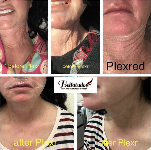 Bellatudo Skin and Wellness Center image