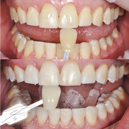 Odontologia en Bogotá l Diseño de sonrisa l Ortodoncia en bogota l Ortodoncia l limpieza dental l Clinica dental Dentu