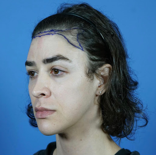 Plastic Surgeon «Gabel Center», reviews and photos, 900 SE Oak St #203, Hillsboro, OR 97123, USA