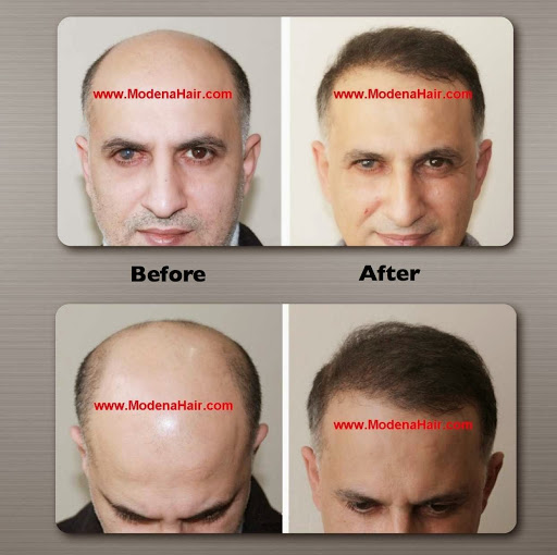 Modena Hair Transplant Institute image