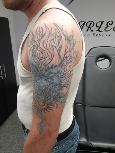 Find best friend matching tattoo ideas for your next unique tattoo in Saint Paul at Fearless Tattoo Removal