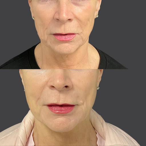 Explore art the clown tattoo ideas, creative tattoo ideas in Whittier, available at Skin Perfect Medical Aesthetics