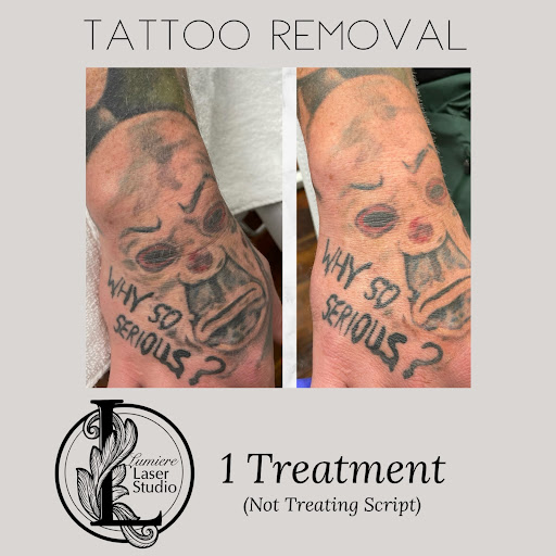 Explore iranian tattoo ideas, creative tattoo ideas in Ballwin, available at Lumiere Laser Studio