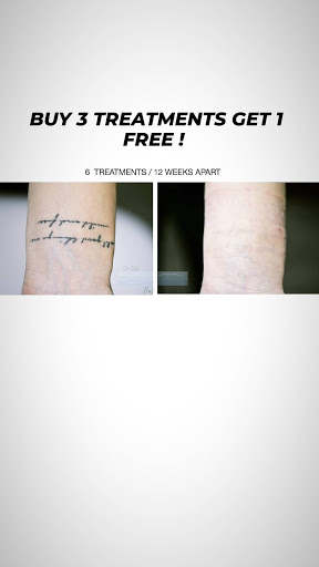 Explore goose tattoo ideas, creative tattoo ideas in Chino, available at SoCal Body Institute