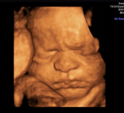 Sweet Miracles 3D/4D Ultrasound