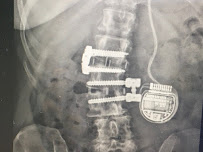 Brio Method - Posture, Personal Training, Wellness - Photo 5 - Car repair in , Round Rock