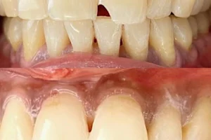 amutham dental care image